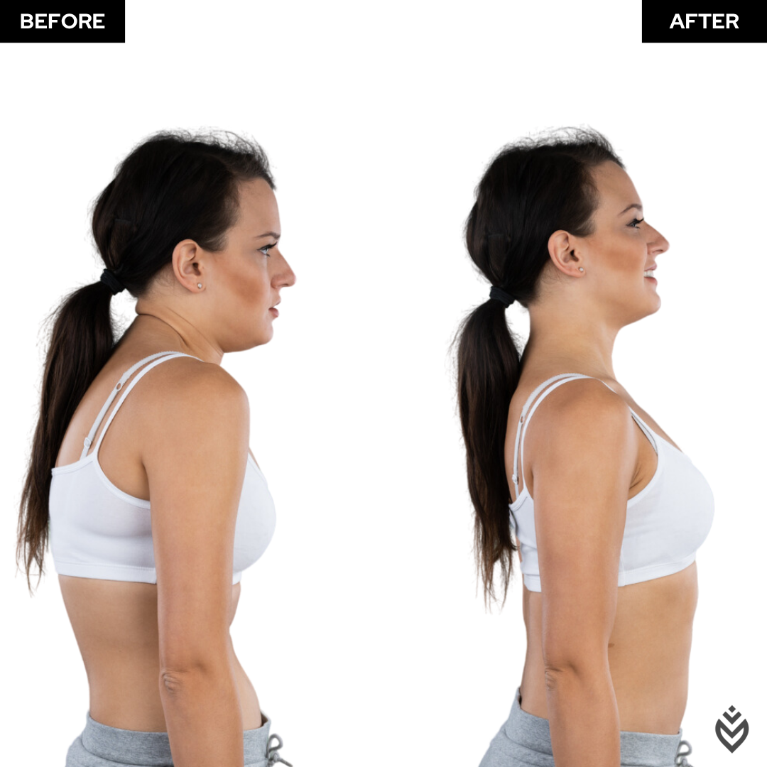 YouCure™ Posture Corrector