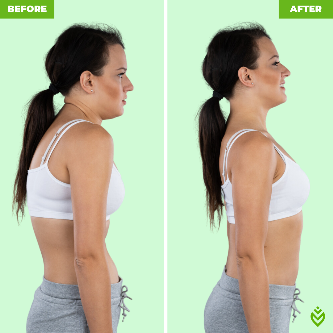 YouCure™ Posture Corrector