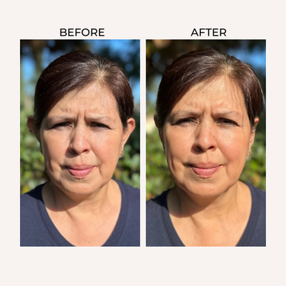 Ear Corrector Cuff